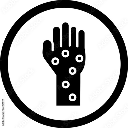 Hand Rash Vector Glyph Black Icon