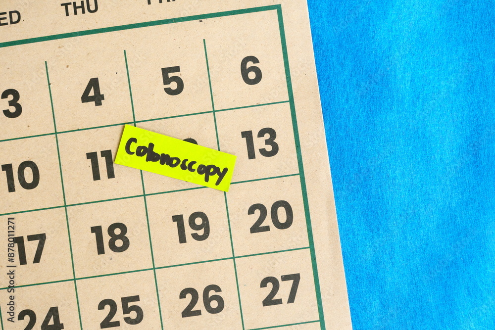 Colonoscopy medical procedure schedule concept. Written reminder note on calendar.