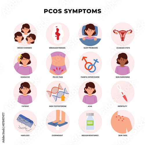 PCOS symptoms infographic medical poster education, labeled polycystic ovary syndrome, Women Health, Female Reproductive System With Ovarian Cysts, reproductive disease, vector illustration.