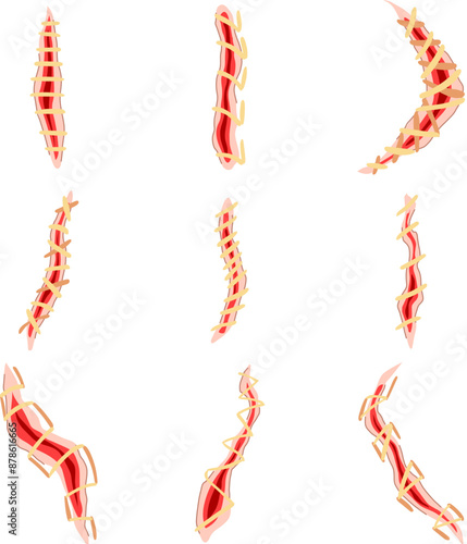 suture set cartoon. skin surgical, needle stitch, doctor cut suture sign. isolated symbol vector illustration