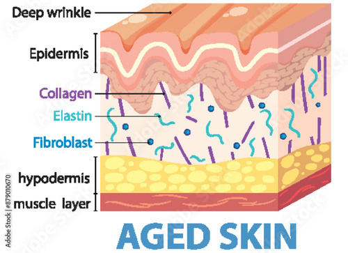 Illustration showing layers and components of aged skin