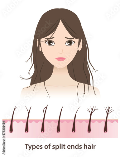 The woman with types of split ends hair vector illustration on white background. Cross section of baby split, y split, incomplete, knot, taper, tree, feather with scalp layer. Hair care concept.