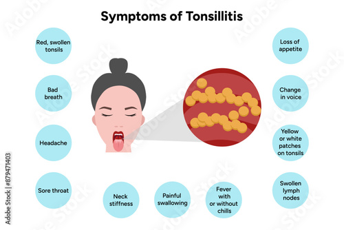 Symptoms of tonsillitis 
