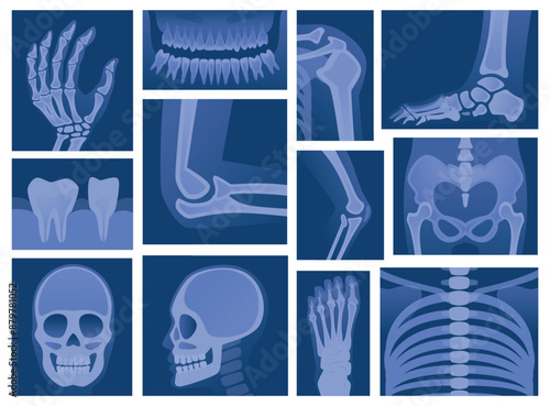 Body parts scanning. X ray skeleton human body medical scan of bones skull legs arms knees exact vector concept pictures
