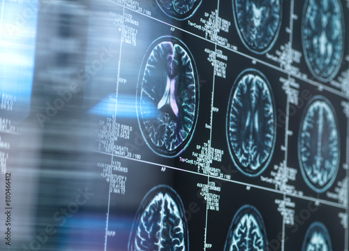 Neurology research, conceptual image
