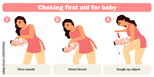 Choking first aid for baby infographic for mother education vector illustration. Heimlich maneuver rescue technique with correct subsequence for unblock infant kid breathing