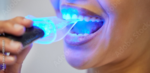 Foto Teeth whitening, LED tool and mouth of person, clinic and treatment in office of dentist and closeup