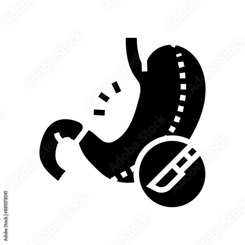 bariatric surgery obesity overweight glyph icon vector. bariatric surgery obesity overweight sign. isolated symbol illustration