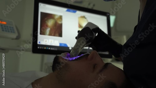 Dental 3d scanner applying process 4k video. Digital impressioning teeth of patient with 3d digital dental scanner. photo