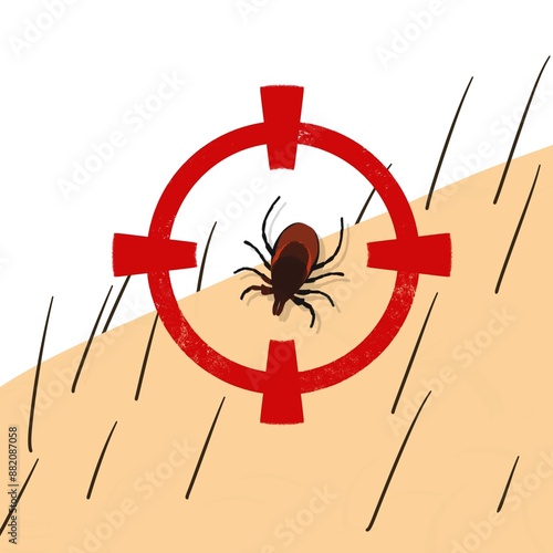 Картината върху платно Crosshair  target on tick, insect biting, sting  on arms, insect control, exterm