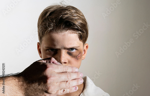 A child a boy face with a bruise a symbol of domestic violence and childhood injuries