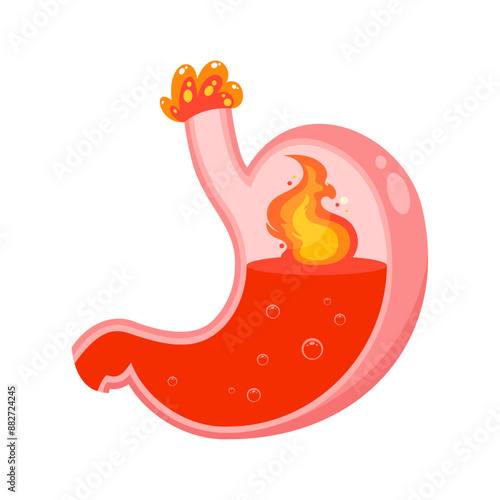 Stomach acid heartburn vector illustration graphic icon
