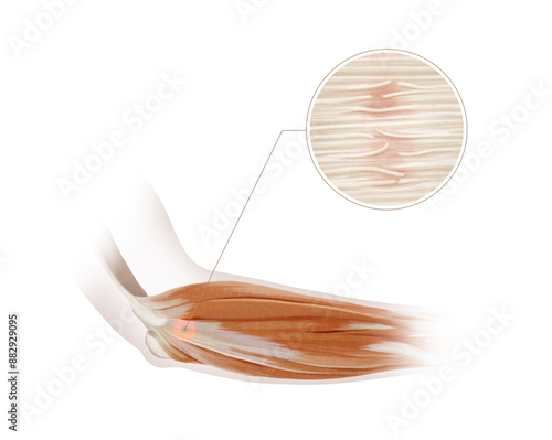 This is a thorough anatomical representation of arm muscles with a detailed focus fasciae