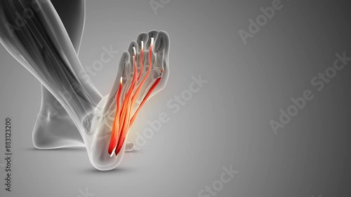 The plantar fascia is a band of tissue photo