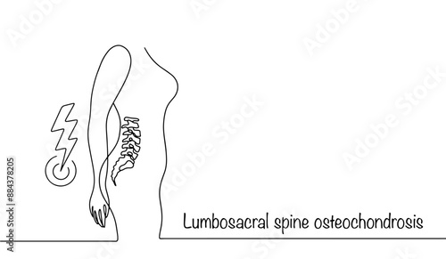 Lumbar osteochondrosis