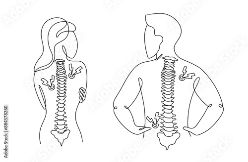 Vertebral osteochondritis