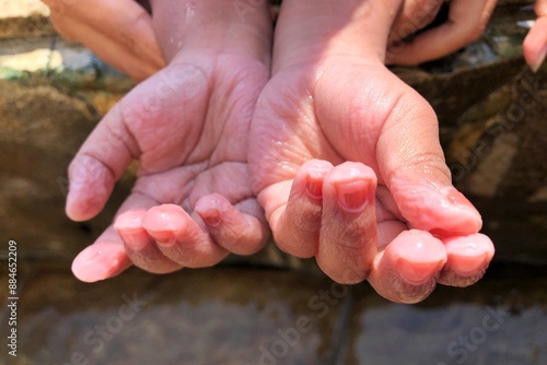 close up of child's fingers wrinkled in cold