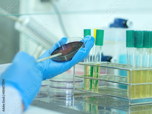 Medical technicians working on bacterial culture and drug resistance of pathogens in laboratory. photo