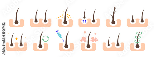 Hair growth set icon. Hair follicle stages, growth cycle, scalp care, injection, dermatology, treatment, hair loss prevention, hair health.