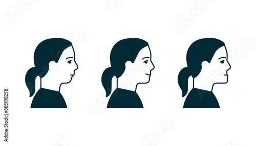 Bite normal jaw and malocclusion, face woman in profile set. Dental problem. Wrong bite, lower jaw extended forward and retracted. Bite correction. Vector illustration