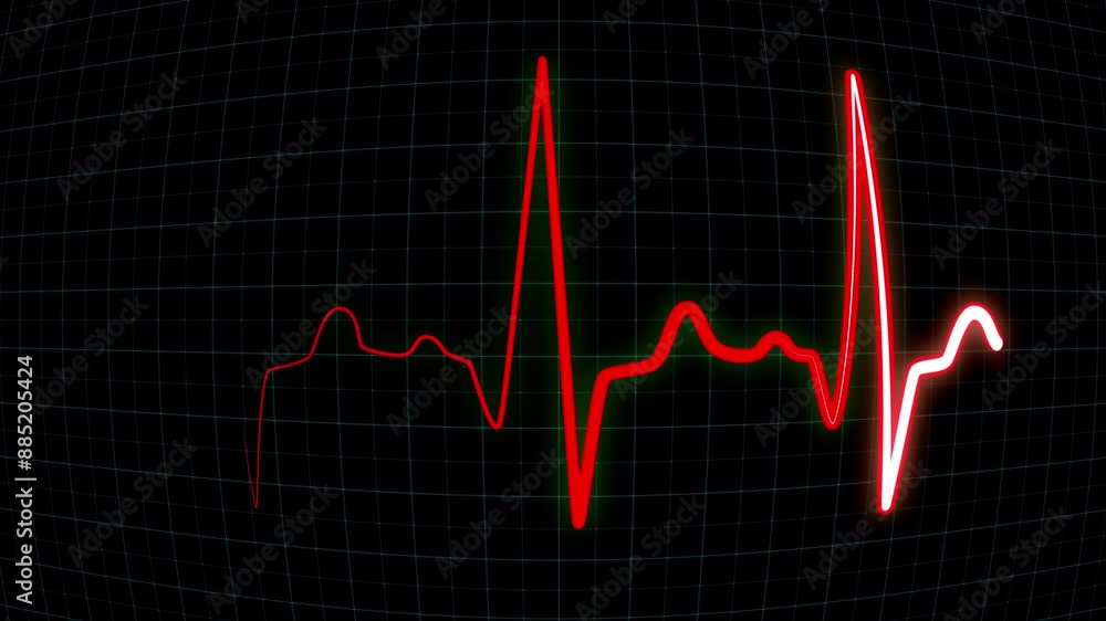 EKG heart beat line monitor. ECG flatline, screen of electrocardiogram machine in close-up, looped seamlessly EKG heart beat line monitor. ECG flatline, screen of electrocardiogram machine in close-up, looped seamlessly