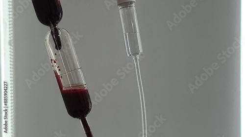 Blood Transfusion