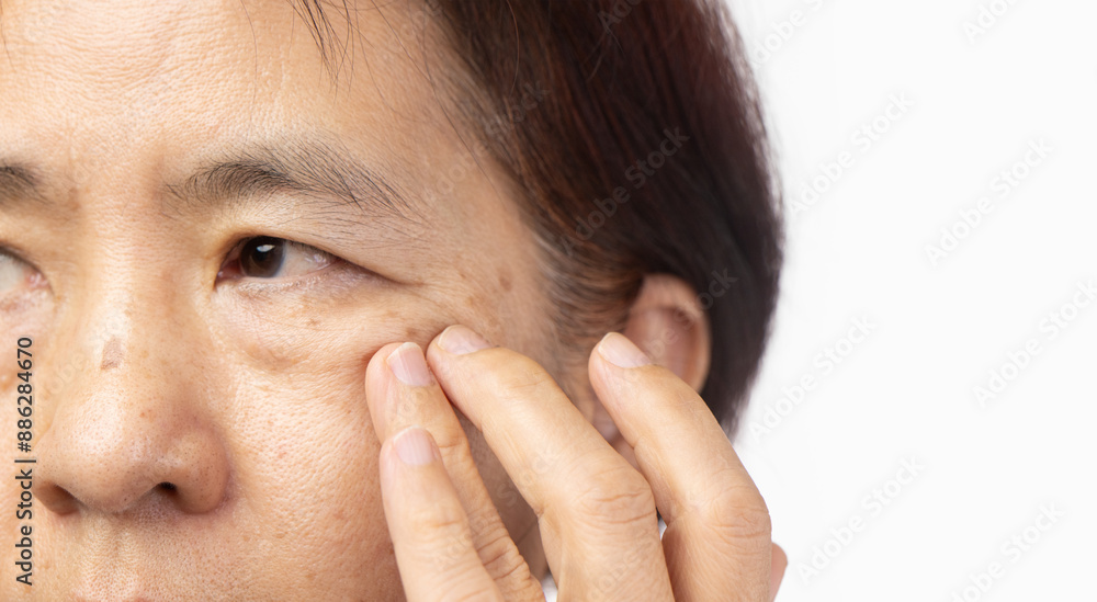 Senior asian woman worry about eye bags and dark spot. Senior asian woman worry about eye bags and dark spot.
