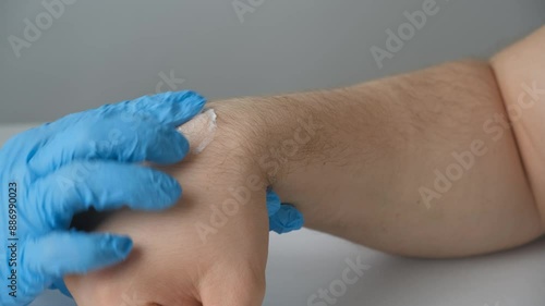 Application of anti-inflammatory cream to the lump, to the cyst, ganglion, hygroma of the wrist. photo