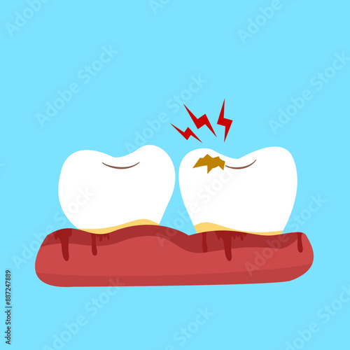 Teeth with bleeding gum or gingivitis inflammation oral problems.