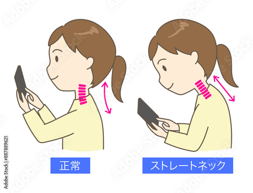 スマホを見ているストレートネックの若い女性の比較イラスト