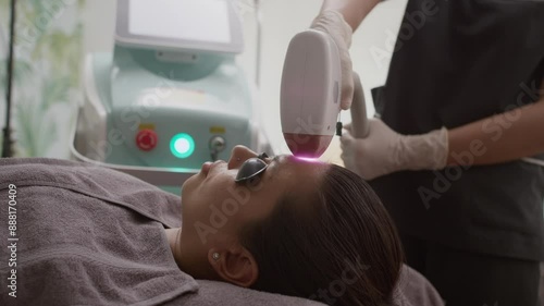 Medium close up of hands of unrecognizable beautician peeling skin on face of Caucasian woman with UV Laser photo