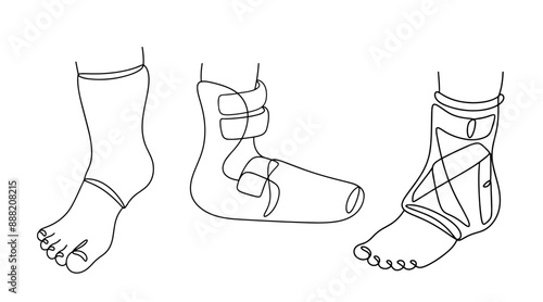 Foot fixation