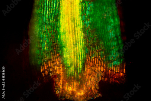 Abstract micrograph of a broom moss leaf, with alar cells.