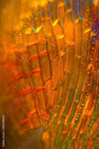 Fotografie Polarization micrograph of a Dicranum moss leaf, with alar cells.