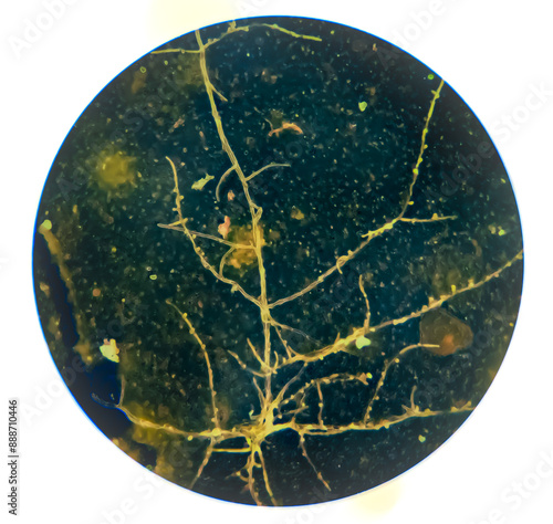 Tablou pe pânză Photomicrograph showing Hyphae of dermatophytes, Nail scraping or skin scraping for fungus test in microbiology laboratory