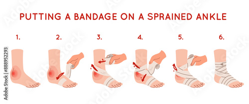 Applying elastic bandage to ankle. Foot injury. Soft tissues swelling. Medical care. First aid. Step by step instructions. Broken bone. Trauma treatment manual. Recent vector infographics