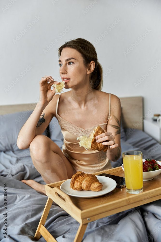 A young woman with vitiligo sits on her bed, eating breakfast from a tray. A young woman with vitiligo sits on her bed, eating breakfast from a tray.
