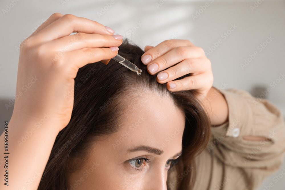 Fototapeta premium Hair loss problem. Woman applying serum onto hairline indoors, closeup