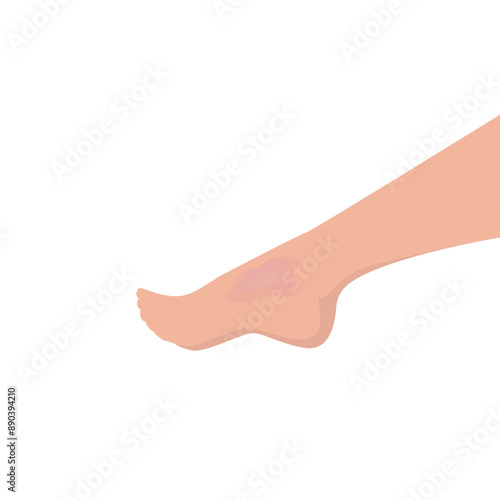 Painful leg concept with pain red circle cartoon flat design vector illustration on white background