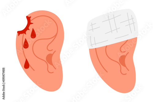 Injured ear with blood drops and and Bandaged human ear. Ear bandage, bullet hole. A sense of injury or pain associated with the ear. Hand drawn trendy flat style isolated Vector illustration