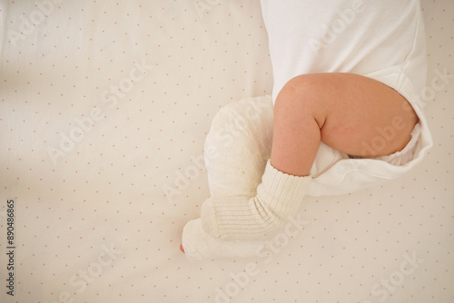 Top view newborn little baby with leg in a cast - clubfoot. Space for text.
