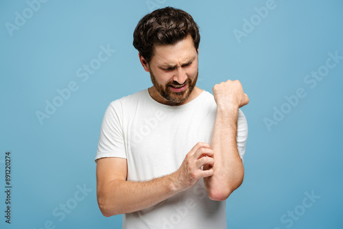 Photography Young man with allergy on the hand suffering from virus, posing over blue backgr