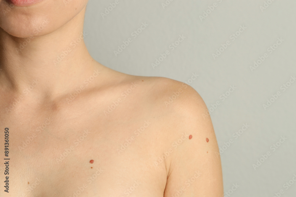 Woman with moles on her skin against light grey background, closeup. Space for text Woman with moles on her skin against light grey background, closeup. Space for text