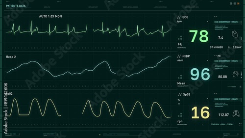 Interface Of Heart Rate Test Equipment Analyzes Patients Health Data. Electrocardiogram Machine Used For Heart Rate Test. Medical Clinic Equipment Testing Heart Rate Of Patient. Evaluating Heartbeat
