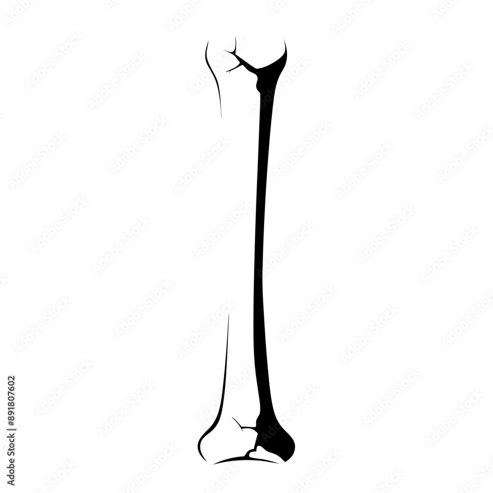 illustration depicting bone in leg that has been fractured, line art, transparent illustration depicting bone in leg that has been fractured, line art, transparent