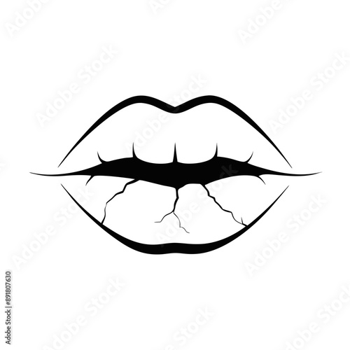basic illustration depicting lips that are cracked and chapped, line drawing