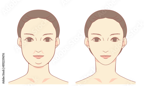 二重あごと小顔のイラスト