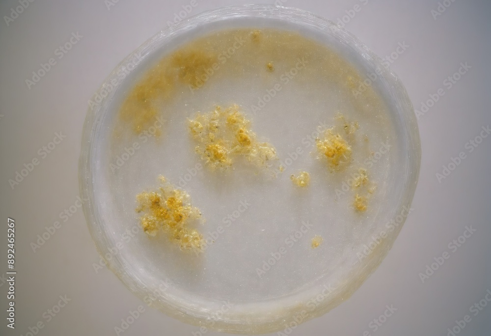 Microscope of mucous mold exploding in natural habitat, transparent filaments, shimmering spores. Microbiology laboratory concepts. Generative AI Microscope of mucous mold exploding in natural habitat, transparent filaments, shimmering spores. Microbiology laboratory concepts. Generative AI