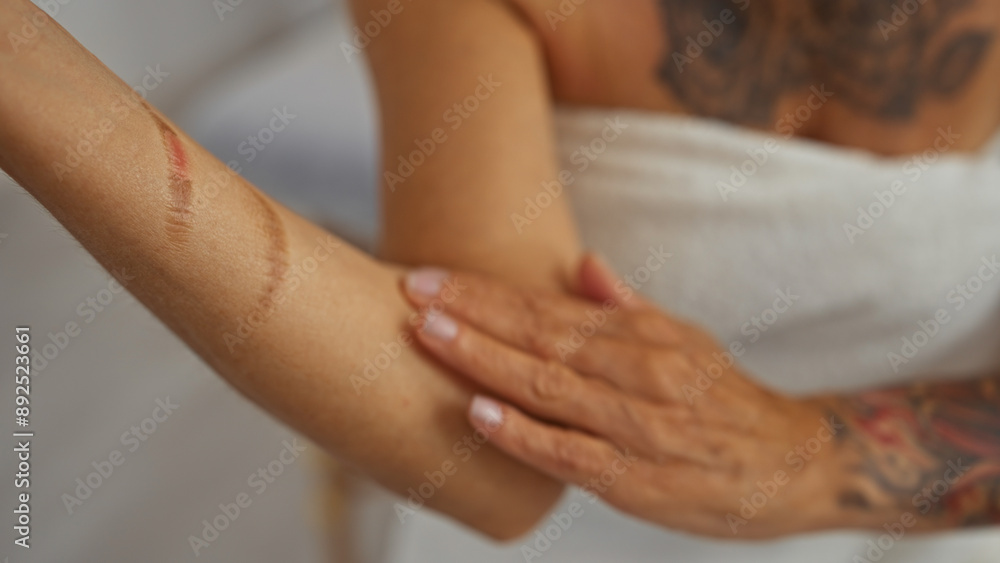 Fototapeta premium Woman applying lotion on arm with scars in spa setting, highlighting self-care, recovery, and wellness.