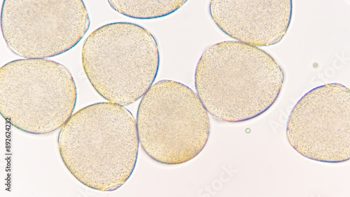 Melon (Cucumis melo) pollen grains under light microscope. Curcubitaceae pollen grains. 400x magnification + 2.8x camera zoom. Fresh sample. Selective focus image. photo